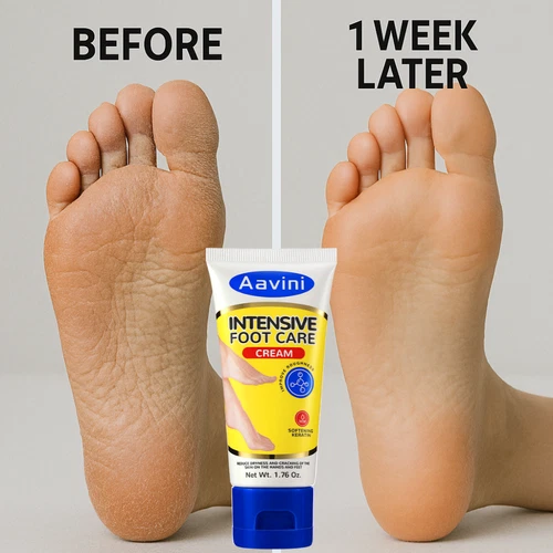 Crema para pies Aavini 50 g - Repara tacones agrietados | Hidratante y antibacteriana - Foto 1 de 16