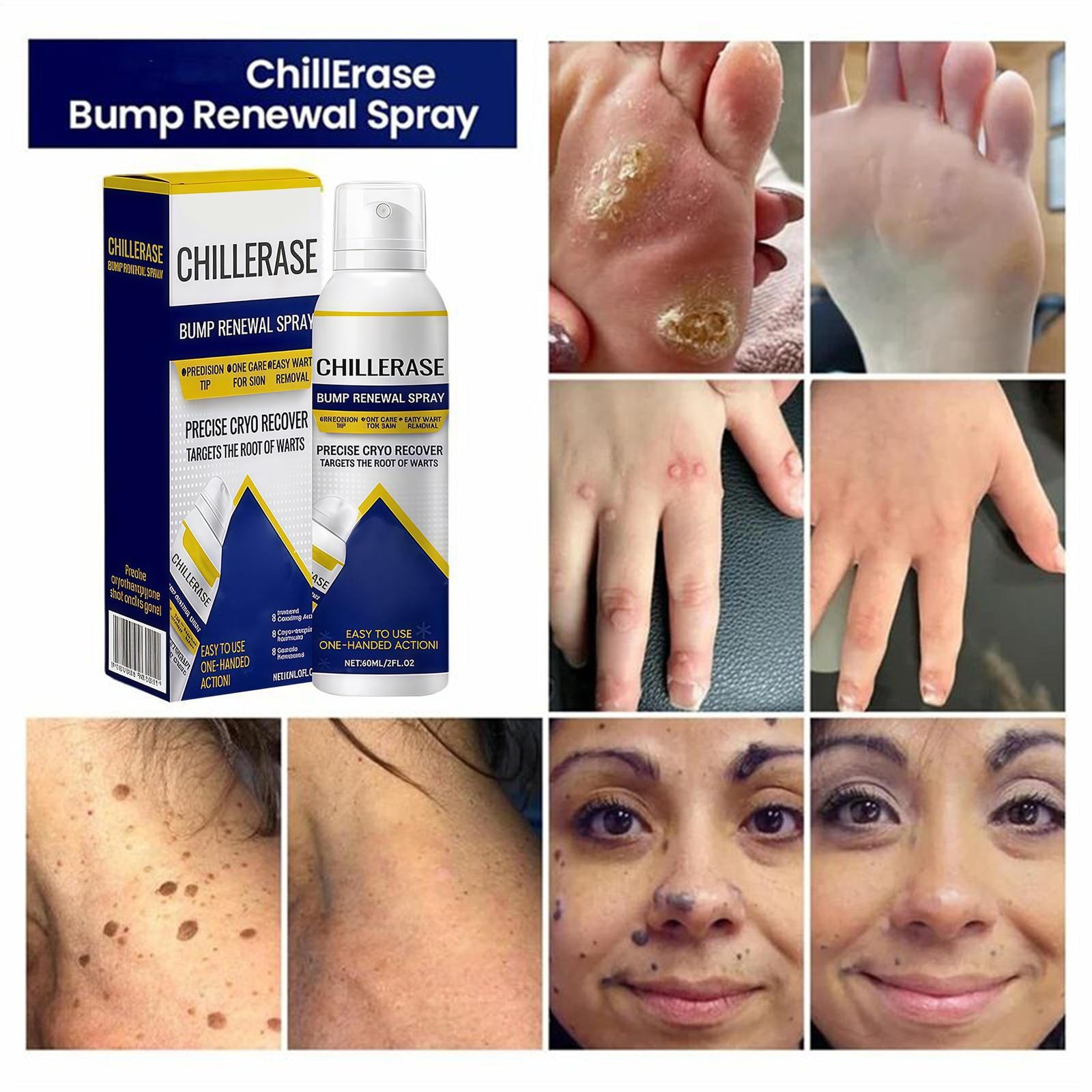 Timilk Chill Erase Bump Renewal Spray Soothing And Cooling Formula Absorbs Quick