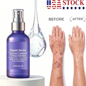 Reunoa Repair Serum Ceramide Serum With Ceramides, Vitamin K, And Arnica