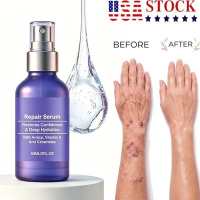 Reunoa Repair Serum Ceramide Serum With Ceramides, Vitamin K, And Arnica