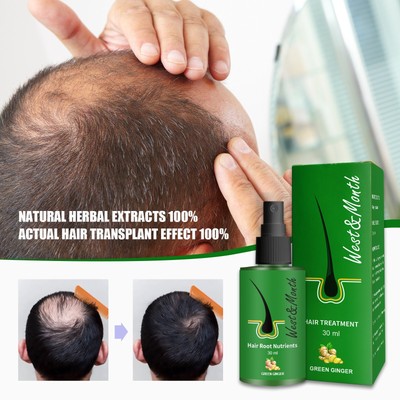 Anti-hair Loss Growth Liquid Ginger Hair-fixing Nutrition