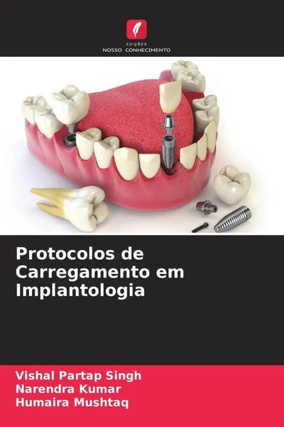 Vishal Partap Singh (U. A.) | Protocolos De Carregamento Em Implantologia | Buch-image