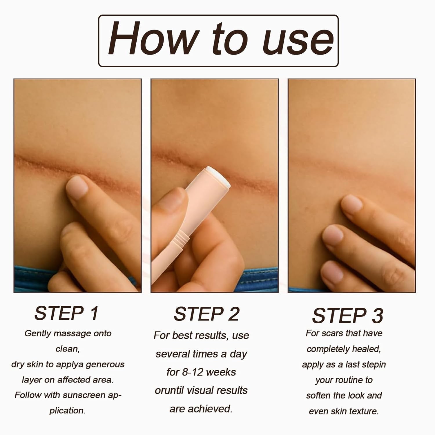 Silicone Scar Stick,containing 60% silicone scar repair ingredients,fades scars.