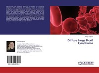 Diffuse Large B-Cell Lymphoma Sanja Trajkova