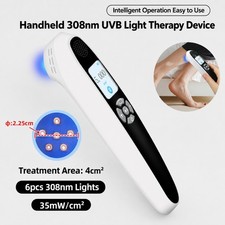 308nm UVB Excimer Phototherapy Device Portable UVB Light Therapy for Skin Spot