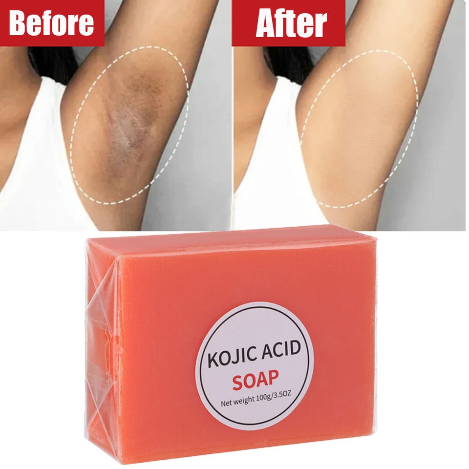Original Kojic Acid Soap for Dark Spots Whitening, Skin Lightening Face