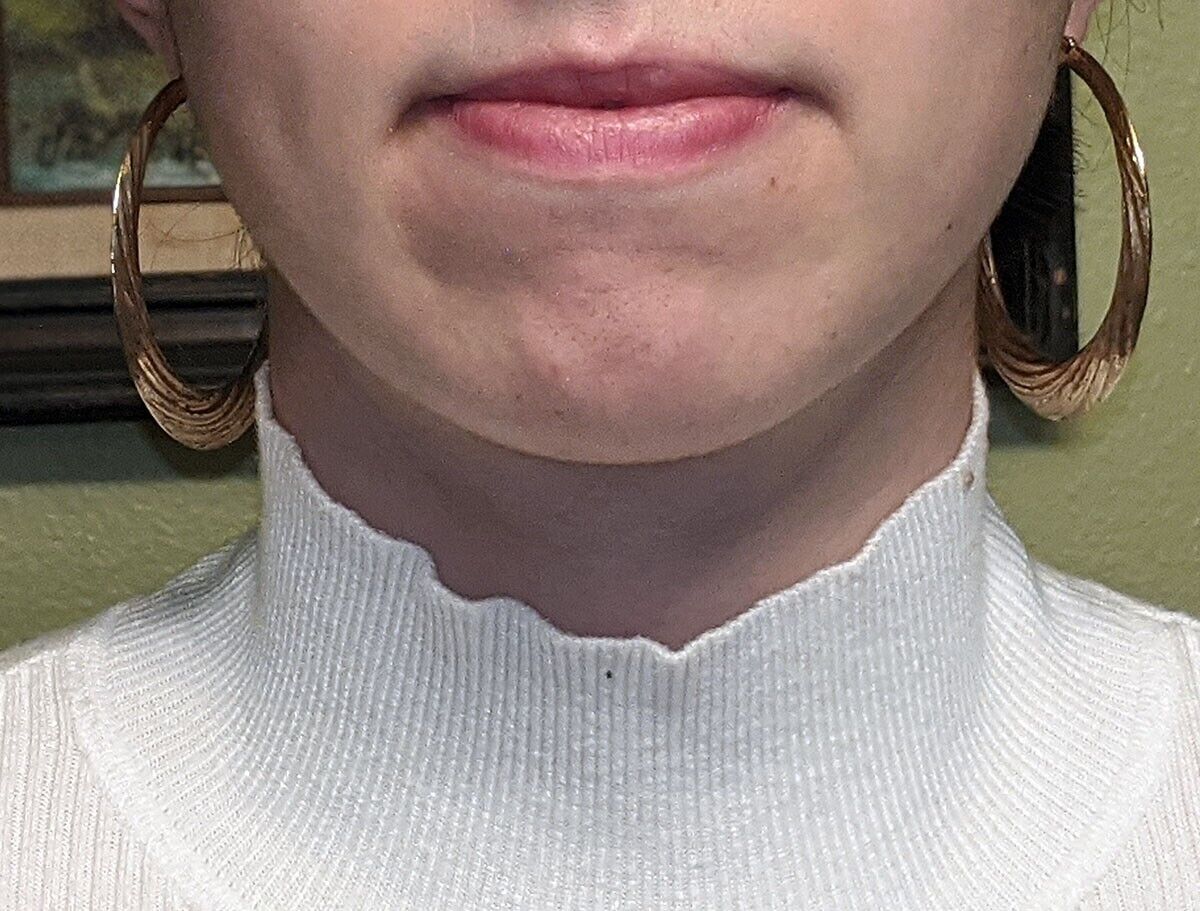 Picture 1 of 24