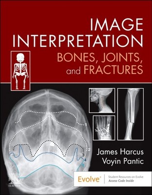 IMAGE INTERPRETATION BONES JOINTS & FRAC by James Lecturer in Diagnostic