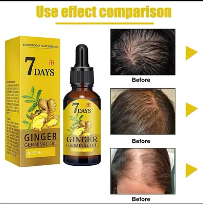 CLOTHES OF SKIN 7 Days Hair Growth Serum Oil, Hair Regrowth Serum, Ginger Germinal Oil 40ml