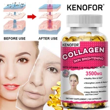 Collagen 1600mg 120 Capsules Skin Hair Nail Anti Ageing Joints Support