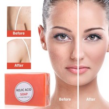Kojic Acid Soap Dark Spot Remover Skin Lightening Face Whitening Body Bleaching