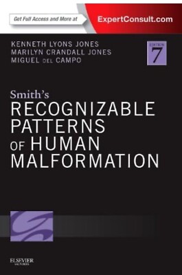 Smith's Recognizable Patterns Of Human Malformation, 7th Edition