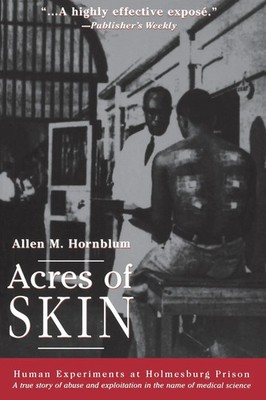 Acres of Skin | Allen M Hornblum | Human Experiments at Holmesburg Prison | Buch