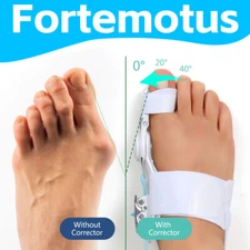 Fortemotus Bunion Fix Toe Valgus Corrector Adjustable Orthosis Foot Women Men