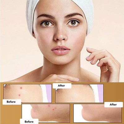 Silikon Scar Tape Roll Wasserdicht Selbstklebend Schneidbar Gentle Scar Tape