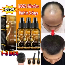 Biotin Hair Growth Spray Anti Hair Loss Fast Regrowth Scalp Treatment Serum US