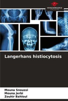 Mouna Snoussi (U. A.) | Langerhans Histiocytosis | Taschenbuch | Englisch (2023)