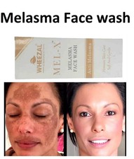 Melasma Face Wash BY Wheezal Mel - X (60ml) for skin pigmentation like melasma