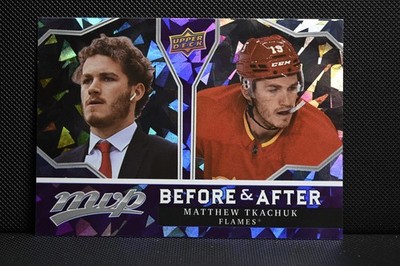 2021-22 Upper Deck MVP - Before and after Matthew Tkachuk #BA-16