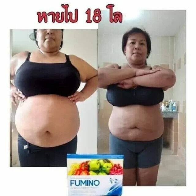 Picture 3 of 11