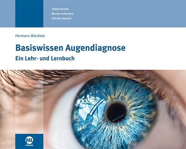 Thumbnail - Basiswissen Augendiagnose