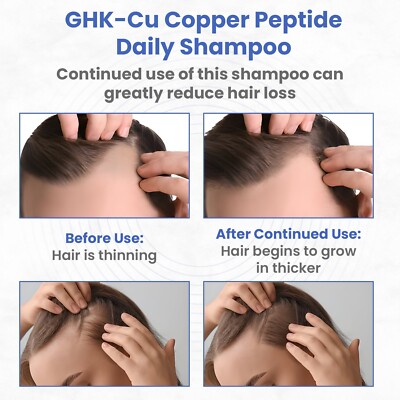 GHK-Cu Copper Peptide Shampoo - Anti-Hair Loss - Promotes New Hair Growth