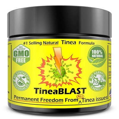 Tinea Versicolor Cream FAST Relief than Soap, Body Wash, Lotion Ointment & Shamp