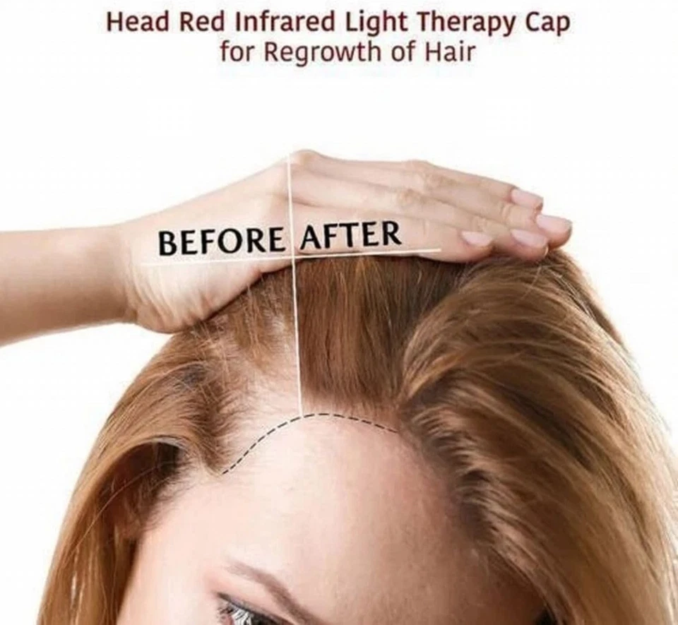 Laser Hair Growth Cap - 4 Mode Red Light Therapy for Scalp Care & Thinning Hair - Image 4 of 4