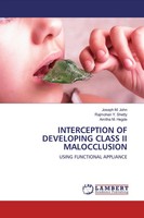 Joseph M. John (U. A.) | Interception OF Developing Class II Malocclusion | Buch