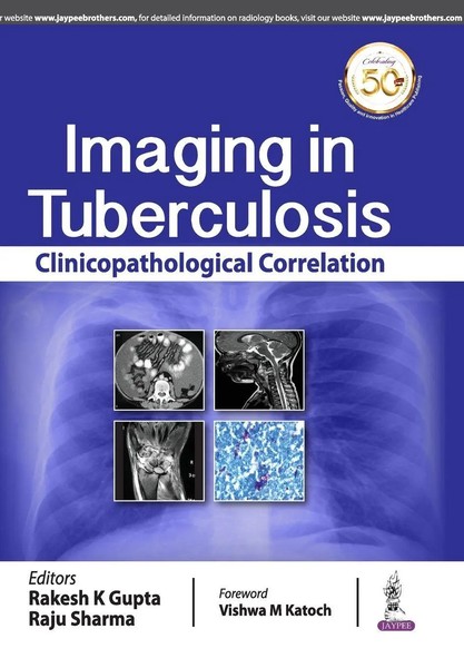 Rakesh K Gupta (U. A.) | Imaging In Tuberculosis | Taschenbuch | Englisch (2019)-image