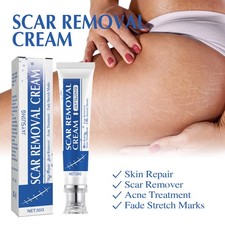 Scar Removal Cream Daily Gentle Moisturizing and Smoothing Body Skin Care Cream