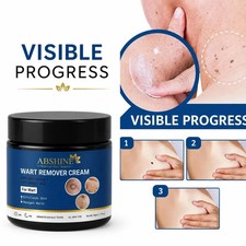 Genital Wart Removal Treatment Cream free packaging included 50 Gram 1.76 oz