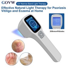 308nm Handheld Ultraviolet Lamp Light Therapy Blue Light Phototherapy 49 Diodes