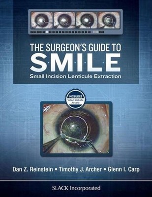 The Surgeons Guide to SMILE: Small Incision Lenticule Extraction by Glenn Carp (
