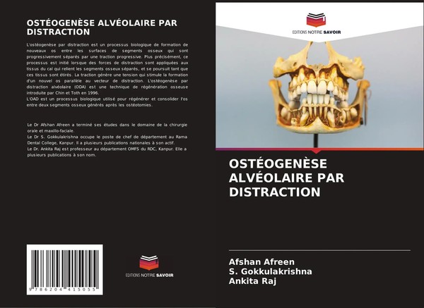 OstÉOgenÈSe AlvÉOlaire PAR Distraction Afshan Afreen (U. A.) Taschenbuch 2022-image