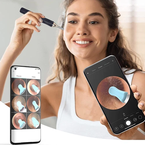 Smart Ear Wax Removal Pick LED Wireless Ear Camera Otoscope Visual Ear Cleaner - Bild 4 von 19