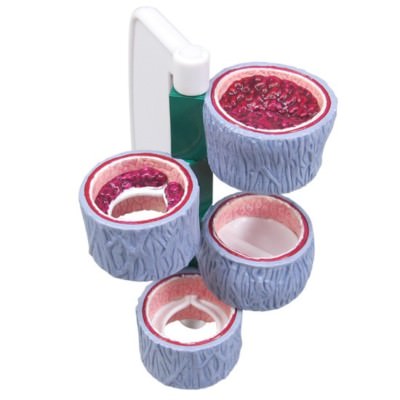 Vein 4-pc Hinged Set GPI Anatomical Model LFA #2655 Make Us An Offer!SEE VIDEO