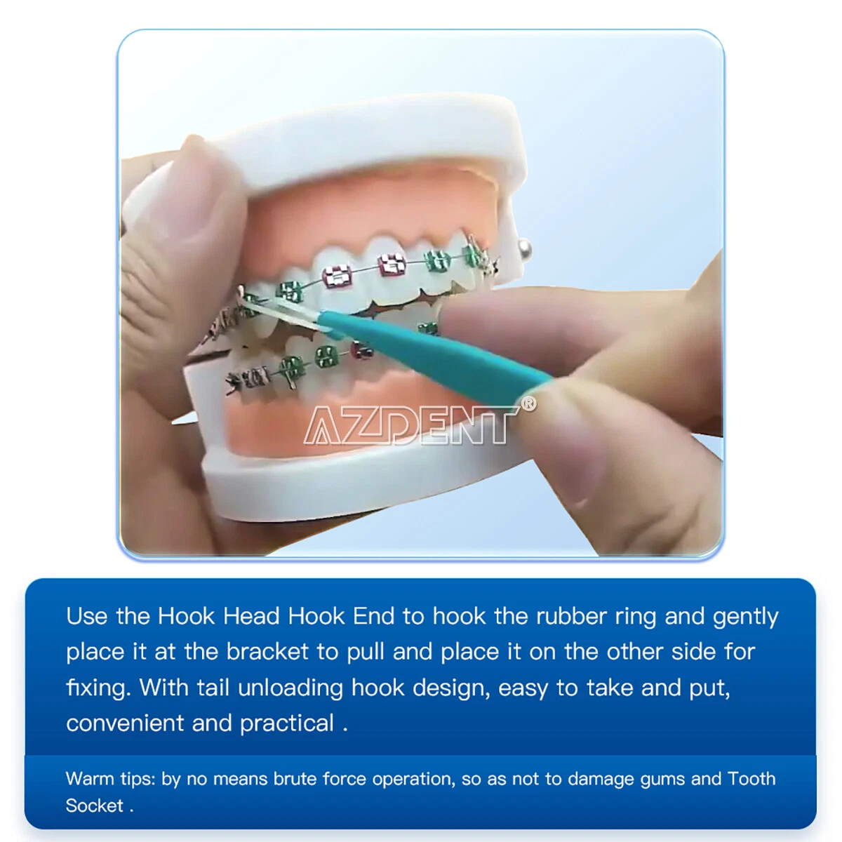 Share more than 146 o ring orthodontics awesomeenglish.edu.vn