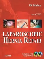 Laparoscopic Hernia Repair | Rk Mishra | Englisch | Buch | Gebunden | 2013