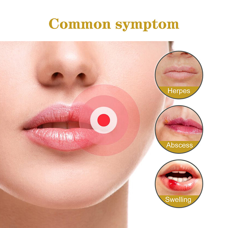 60 Cold Sore Patches Acne Spot Pimple Skin Breathable Blemish