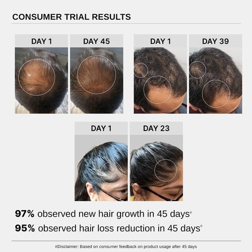 Bare Anatomy Advanced Hair growth serum : Rosemary, Biotin & Rice Extract : 30ml - Picture 4 of 8