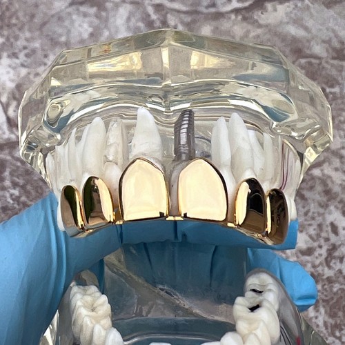 14k Gold Plated Grillz Permanent Cuts Perm Cut Six Top Teeth Pre-Made Grills - 第 2/8 張圖片