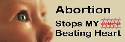 Abortion Stops My Beating Heart Pro-Life Bumper Sticker