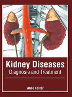 Alice Foster | Kidney Diseases | Buch | Englisch (2022) | Gebunden