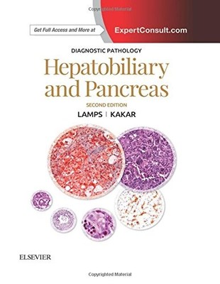 DIAGNOSTIC PATHOLOGY: HEPATOBILIARY AND PANCREAS, 2E By Lamps Laura W. Md NEW