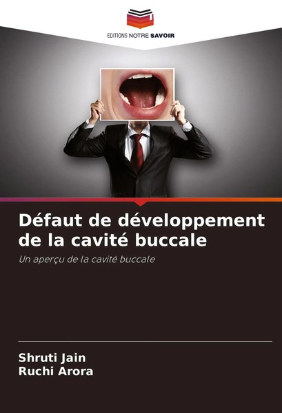 Shruti Jain (U. A.) | DéFaut De DéVeloppement De La Cavité Buccale | Taschenbuch-image