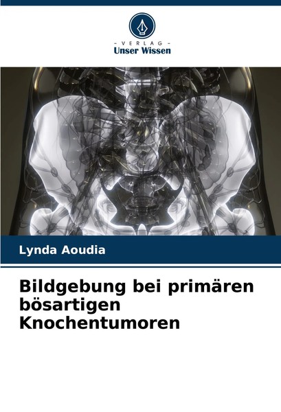 Bildgebung Bei PrimäRen BöSartigen Knochentumoren Lynda Aoudia Taschenbuch 2024-image