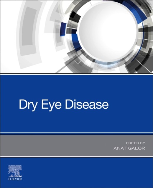 Dry Eye Disease by Anat  Galor (Paperback Book)