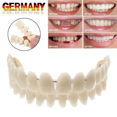 Snap On Veneers Kosmetische Zahnblende Comfort Prothese Falsche Zähne Flex