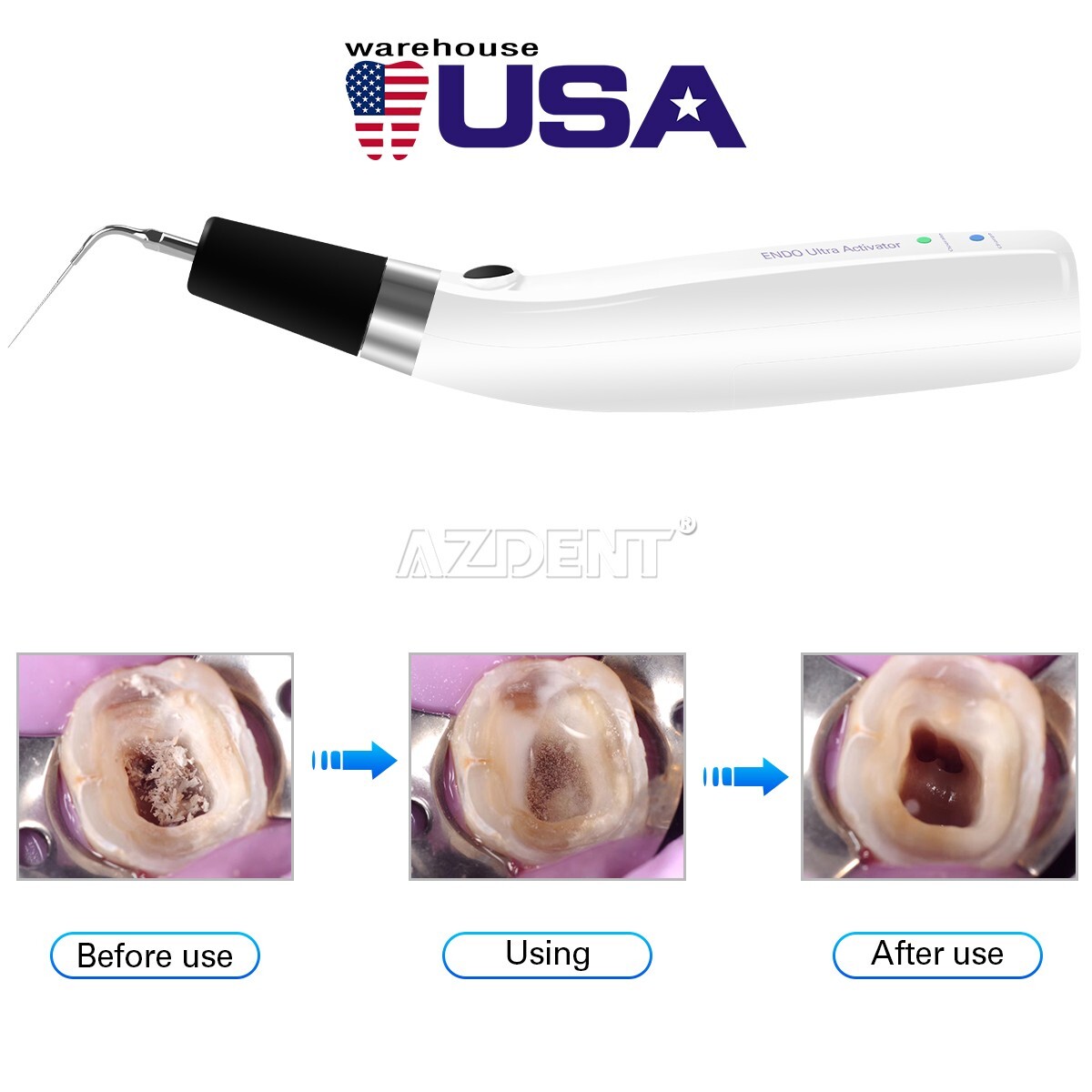Dental Endo Ultra Activator Ultrasonic Endo Irrigator Root Canal Handpiece Tips